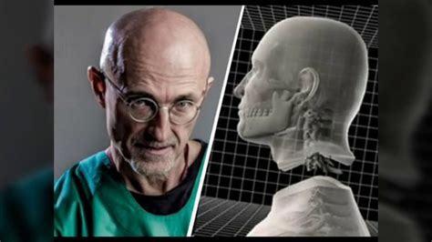 sergio canavero|The first human head transplant: 'it will be a success'.